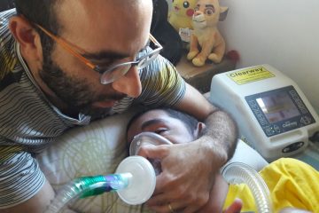 אושרה פיזיותרפיה נשימתית לחולי A-T בסל הבריאות